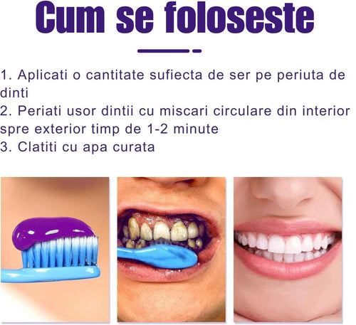 Violet Smile – Ser Corector pentru Albirea Dinților